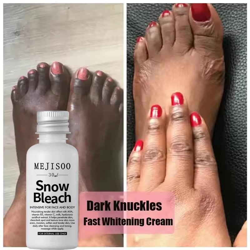 Fast Whitening Dark Knuckles B - огляд і ціна Korean Skincare Routine